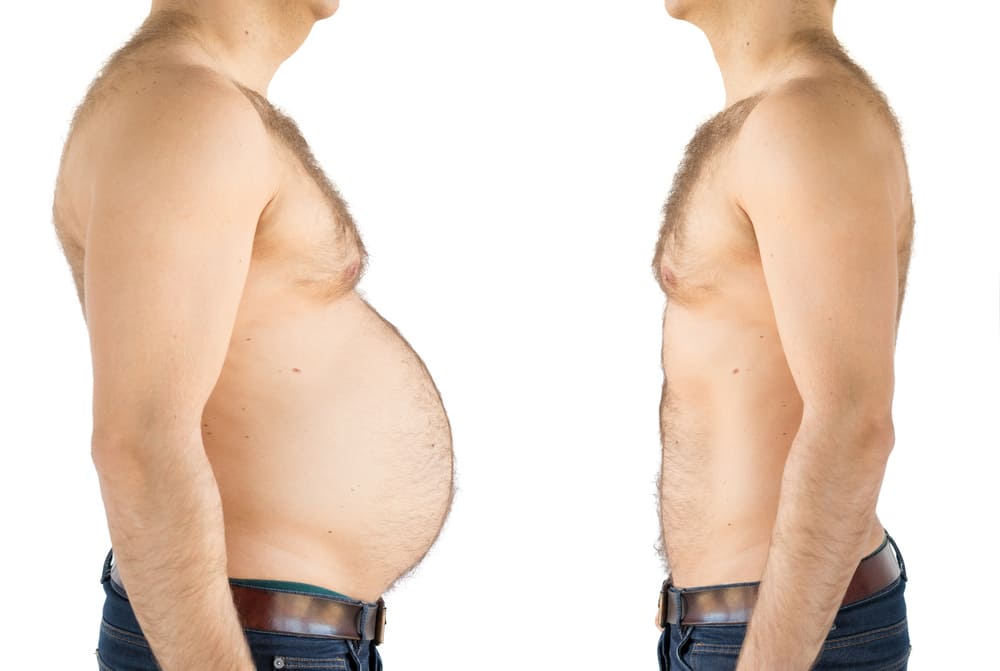 man-before-after-weight-loss (1) (1)