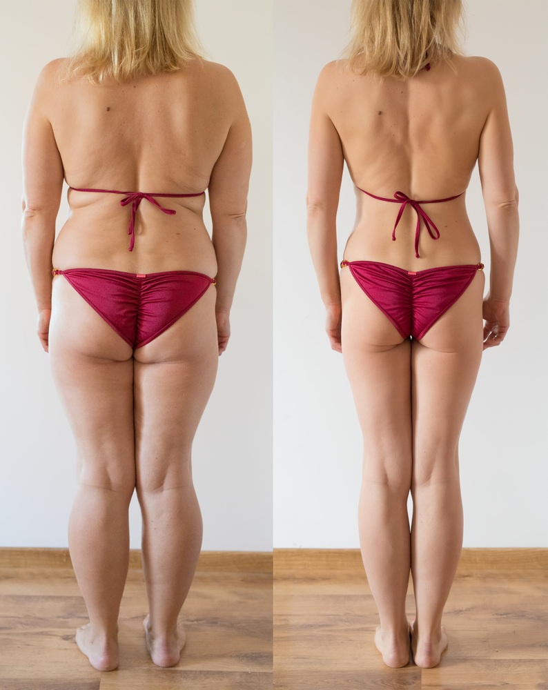 woman-posing-home-before-after-weight-loss-diet-min(1) - Copy (1)