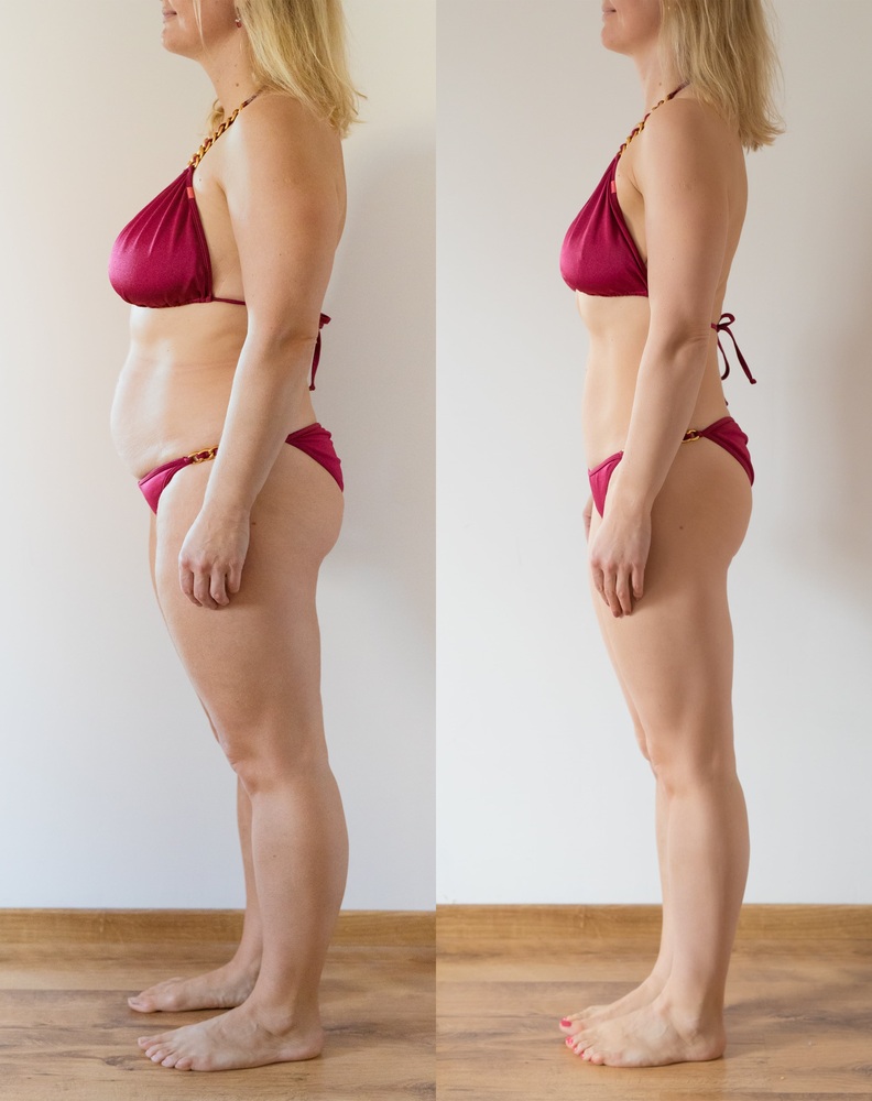 woman-posing-home-before-after-weight-loss-diet-min(2) - Copy (1)